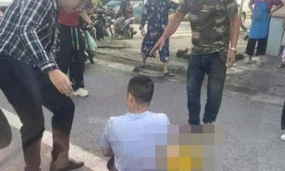 Cảnh sát hình sự thụ lý vụ TikToker Hà List bị chém gần đứt lìa bàn tay