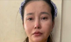 Nữ bị can phẫu thuật thẩm mỹ để trốn truy nã vẫn không thoát