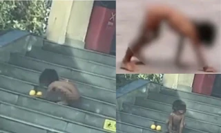 "Đứa trẻ người rừng" ở Trung Quốc gây xôn xao, cha mẹ bảo muốn "thuận tự nhiên"