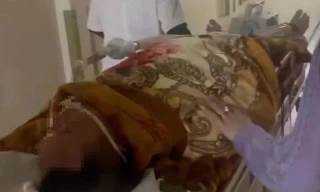 Người đàn ông nguy kịch nghi nhiễm liên cầu khuẩn lợn sau khi ăn tiết canh dê