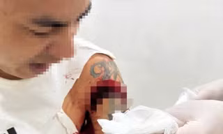 Người đàn ông bị chém trọng thương khi đang ngồi uống cà phê