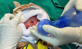 Giành giật sự sống cho trẻ sinh non chỉ nặng 900 gram