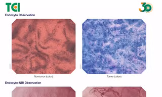 Endocyto 520x – Khi nội soi không chỉ nhìn thấy tổn thương mà đi sâu đến cấp độ tế bào 