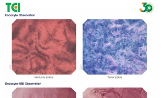 Endocyto 520x – Khi nội soi không chỉ nhìn thấy tổn thương mà đi sâu đến cấp độ tế bào 