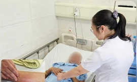 Nhiễm trùng máu vì 'cấy chỉ' chữa đau lưng