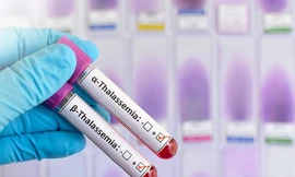 Đừng để trẻ sinh ra phải truyền máu suốt đời: Thalassemia có thể phòng ngừa