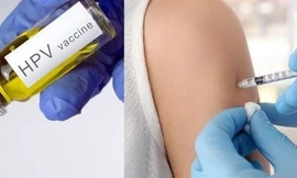 Phát hiện muộn, hàng nghìn phụ nữ tử vong vì ung thư cổ tử cung mỗi năm