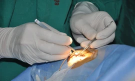 Ra mắt Ngân hàng Mô, cơ hội ghép giác mạc cho hàng nghìn bệnh nhân