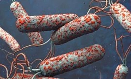 Dịch tả bùng phát tại nhiều quốc gia, Việt Nam siết chặt giám sát