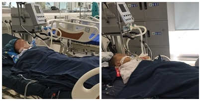 Nghịch phá tổ ong, 2 trẻ nguy kịch vì suy đa phủ tạng