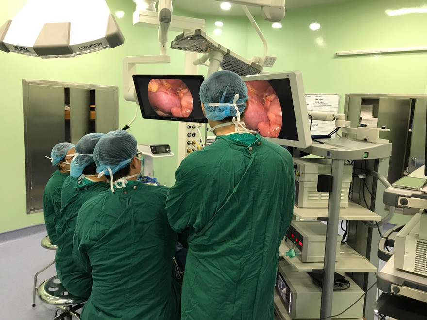 Bác sĩ đang phẫu thuật nội soi nang ống mật chủ tại BV Nhi T.Ư