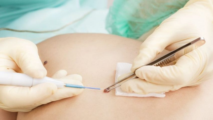 Ảnh minh hoạ: Internet