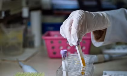 Tưởng rối loạn tiền đình, người phụ nữ mắc viêm màng não do nấm 