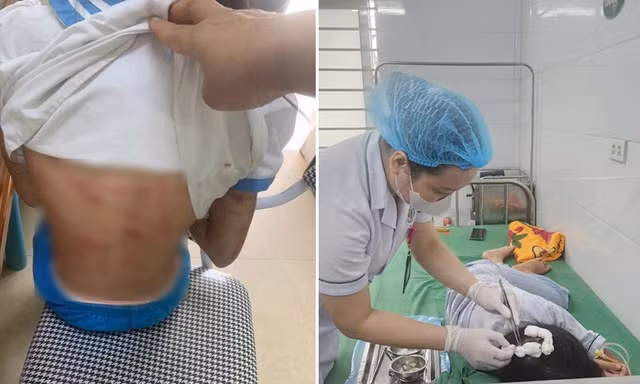 Cha dượng bạo hành bé gái lớp 5 ở Hà Tĩnh có thể đối diện với mức án nào?