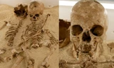 Bệnh lùn hiếm gặp bất ngờ được phát hiện từ hài cốt cách đây 12.000 năm tại Ý
