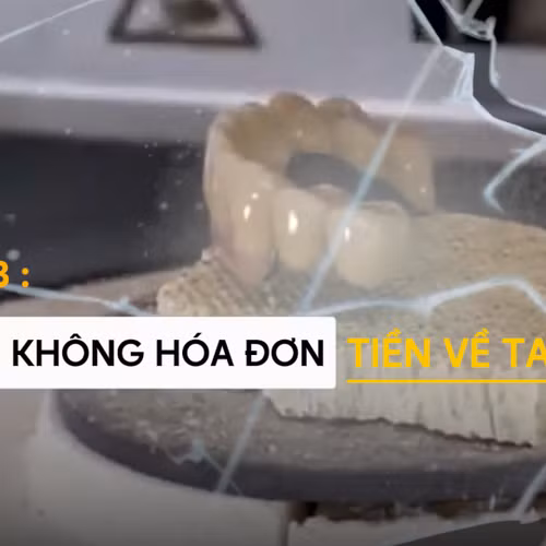 Kỳ 3: Răng sứ không hóa đơn, tiền về tay ai?