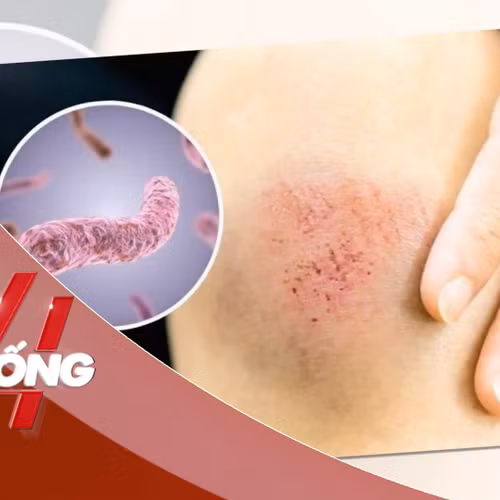 NHỊP SỐNG 24: 23 người ở Thái Lan tử vong do bệnh ‘sốt đất’ , Bộ Y tế Việt Nam ra khuyến cáo