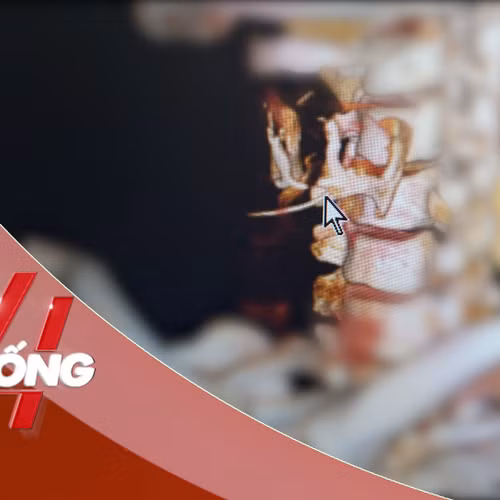 NHỊP SỐNG 24: Cố nuốt cơm chữa hóc xương, người đàn ông 35 tuổi thủng thực quản