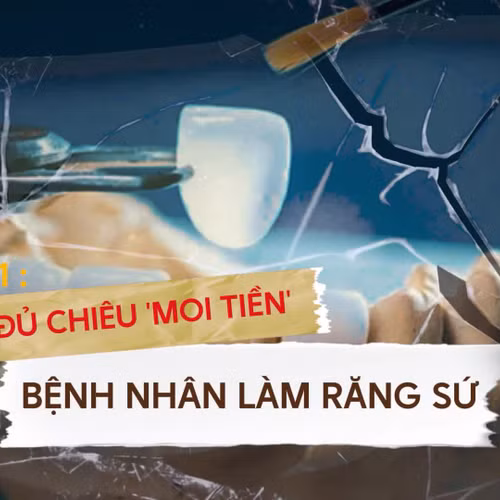 Đủ chiêu ‘moi tiền’ bệnh nhân làm răng sứ