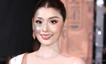 Người đẹp bị chàm nửa gương mặt giành giải á hậu
