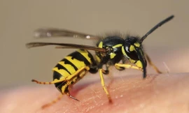 Cụ bà ngừng tim, phải thở máy vì nhiễm khuẩn từ vết bé tý do ong đốt