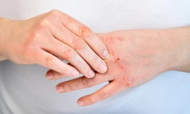 Ảnh minh họa: Internet