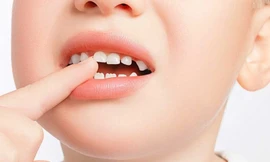 Ảnh minh họa: Internet