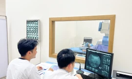 Có nên tán sỏi thận?