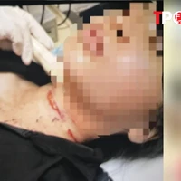 HÌNH SỰ: Bất ngờ lý do cô gái bị 'cắt cổ, cướp của' ở Bình Dương