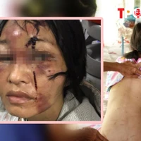 HÌNH SỰ: Hai mẹ con bị gã 'chồng hờ' đánh đập dã man