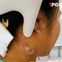 ĐIỂM TIN 2/9: Công điện khẩn về bão Yagi; Vi khuẩn 'ăn thịt người' xuất hiện ở Đồng Nai