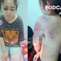 ĐIỂM TIN 28/10: Cô gái bị bạn trai bạo hành 13 tiếng; 'Cô đồng' lừa đảo 28 tỷ đồng