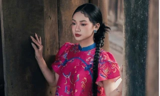 Nữ sinh 10X và đôi mắt ‘hai màu’ kỳ lạ