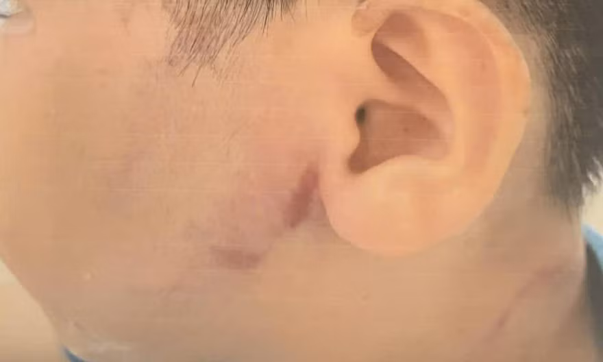 TPHCM: Nghi vấn bé trai 8 tuổi nhập viện do bị cha đánh
