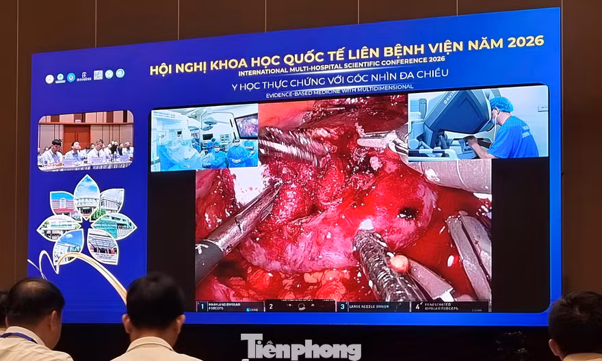 Phát trực tiếp robot phẫu thuật tiết niệu, thay khớp gối 