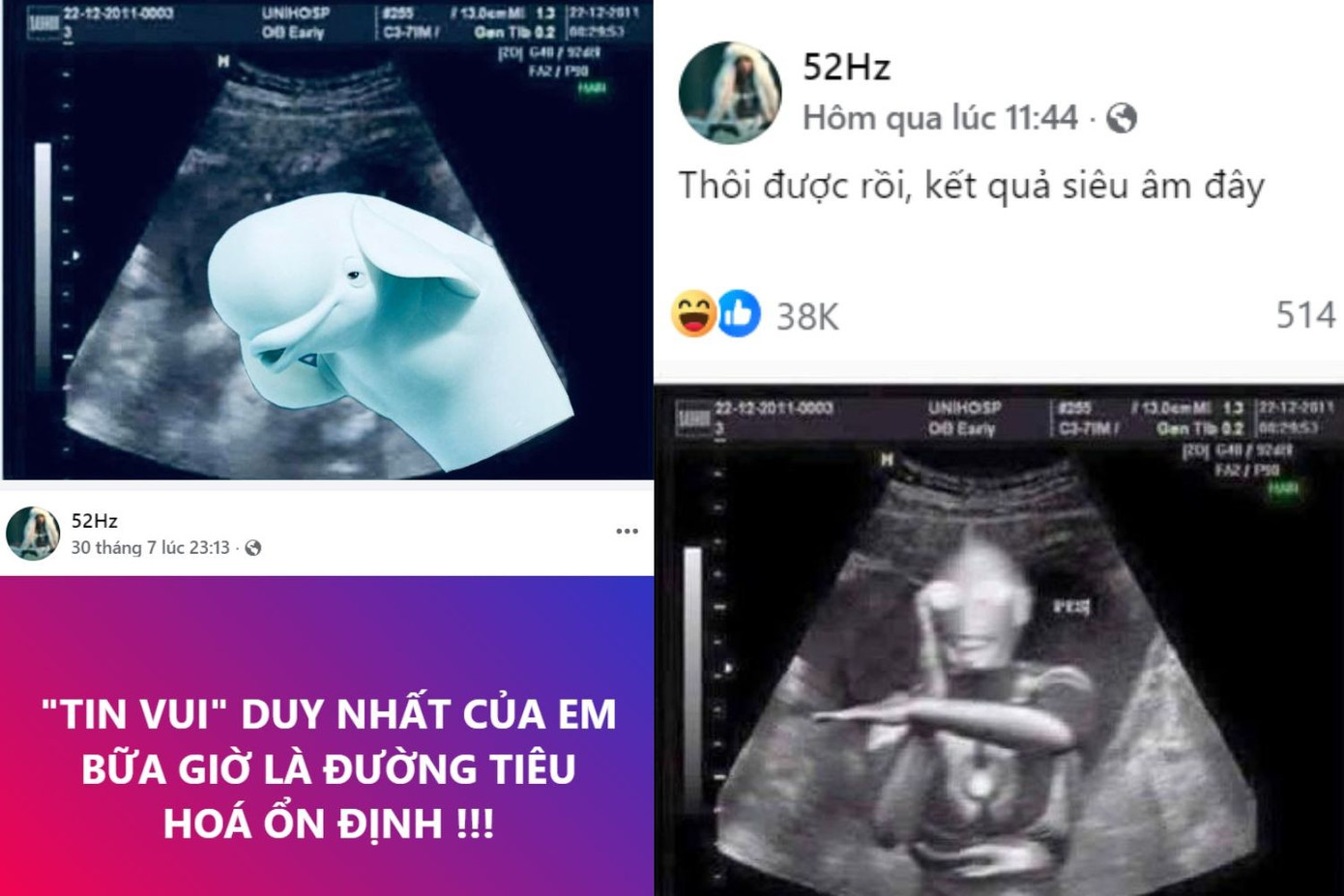 52Hz hóm hỉnh chia sẻ tình trạng sức khỏe hiện tại. cover.jpg