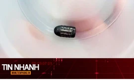 TIN NHANH: Hy hữu người phụ nữ sống sót dù bị đạn lạc găm trúng đầu