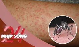 NHỊP SỐNG 24: Vì sao Chikungunya dễ nhầm với sốt xuất huyết?