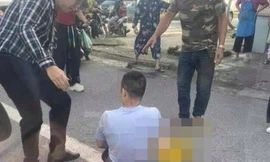 Cảnh sát hình sự thụ lý vụ TikToker Hà List bị chém gần đứt lìa bàn tay