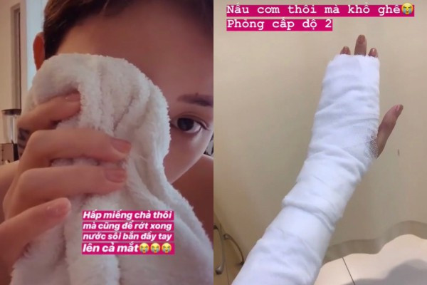 Mặc dù vết thương không quá nặng, tuy nhiên câu chuyện hi hữu này như một lời nhắc nhở khán giả nên cẩn trọng mỗi khi xuống bếp. Mặc dù vết thương không quá nặng, tuy nhiên câu chuyện hi hữu này như một lời nhắc nhở khán giả nên cẩn trọng mỗi khi xuống bếp.