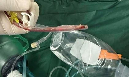 Bé gái 3 tuổi tử vong sau khi sặc thức ăn tại lớp mẫu giáo ở TPHCM