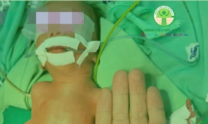 ‘Nhường’ máu nuôi người anh song thai, bé trai sinh non nguy kịch