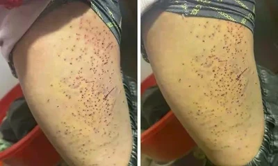 Nguyên nhân vụ học sinh lớp 7 ở Lào Cai bị bạn cùng lớp dùng bút đâm vào đùi