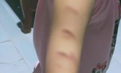 Toàn cảnh vụ nữ sinh lớp 5 ở Cà Mau bị chị họ học cùng lớp rạch tay