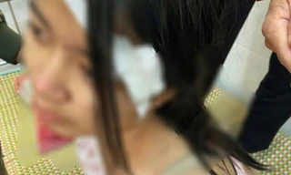 Vụ trẻ 13 tuổi bị bà nội và 2 người đàn ông tra khảo, đánh đập: Cháu bé có hoàn cảnh éo le