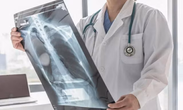Ung thư phổi không còn là án tử: Vũ khí từ liệu pháp trúng đích và cá thể hóa