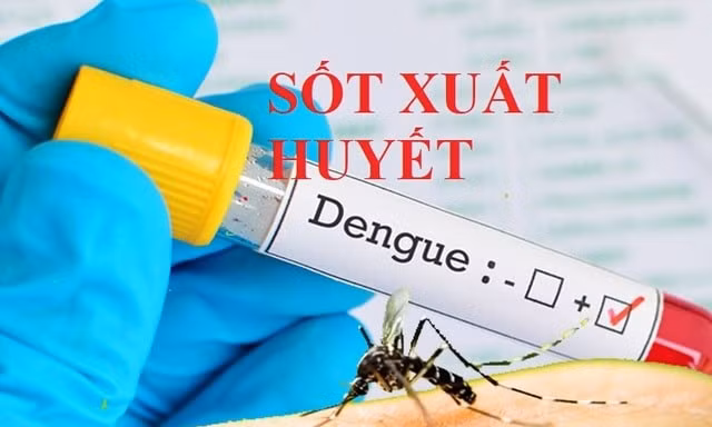 Hà Nội: Số ca mắc sốt xuất huyết tăng, thêm nhiều ổ dịch mới
