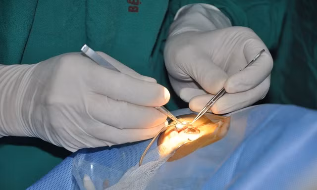Ra mắt Ngân hàng Mô, cơ hội ghép giác mạc cho hàng nghìn bệnh nhân