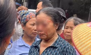 Tranh chấp chỗ bán hàng, một phụ nữ bị xịt nước cao áp đến chảy máu mắt