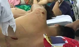 Cơ thể của anh Liêm bị nhiều vết chém